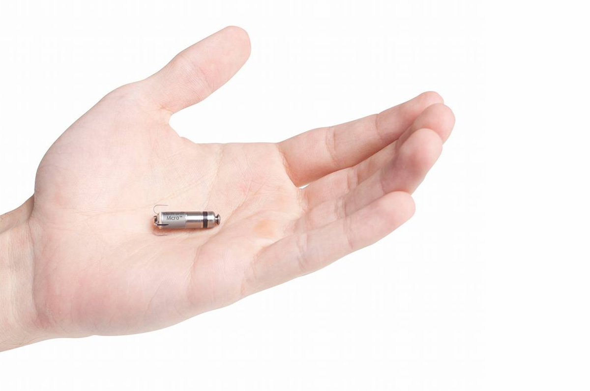 “Bonomo”, impiantati i pacemaker più piccoli al mondo