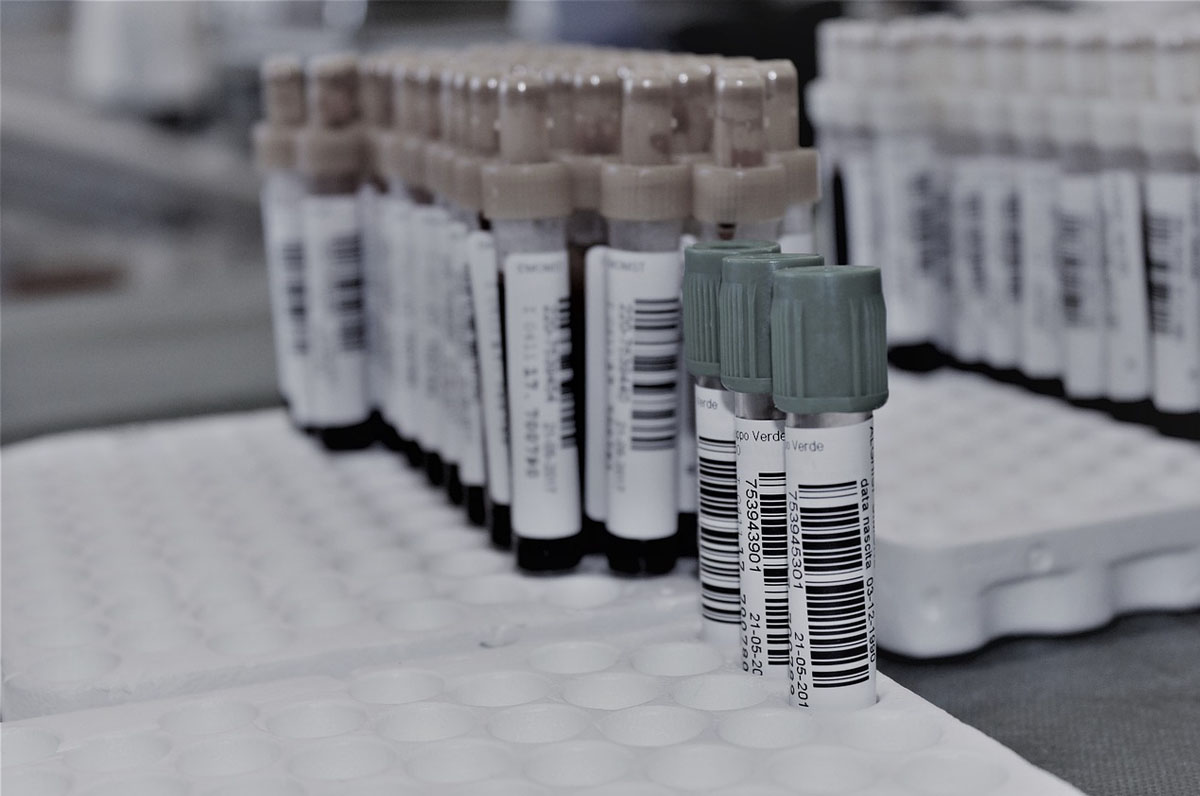 Tumore al seno, incredibile ricerca dell’Uniba sulle metastasi