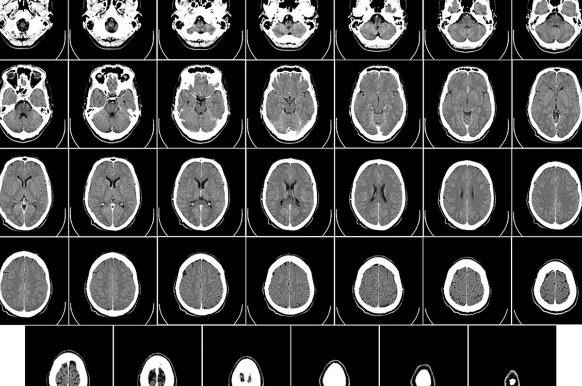 Foggia, attivati gli esami radiologici via web Foggia, attivati gli esami radiologici via web